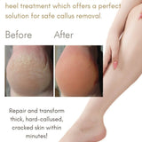Summer Heel Professional Kit